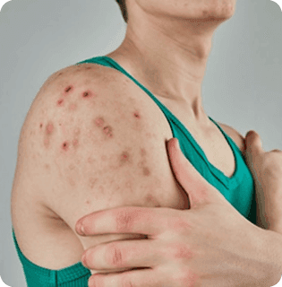 Rashes & Irritations